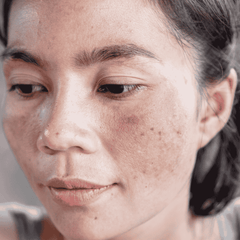 Collection image for: Pigmentation