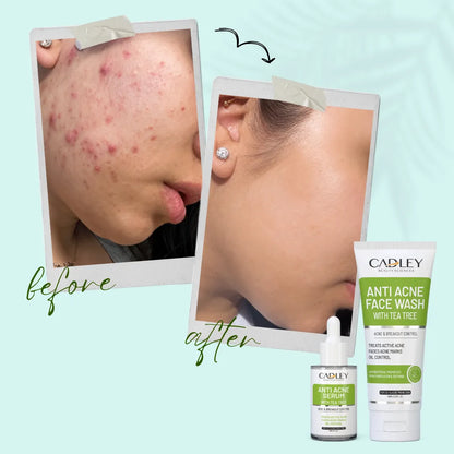 Anti Acne Duo