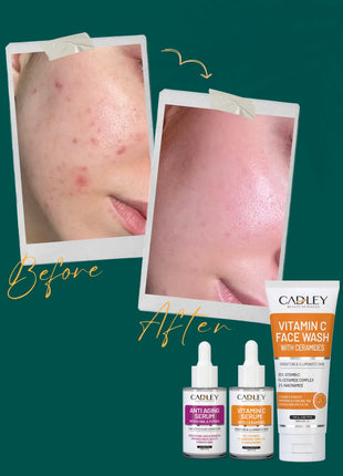 Anti Aging + Brightening Bundle