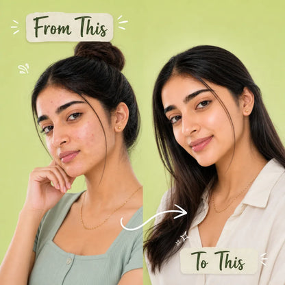 Anti Acne Face Wash with Tea Tree