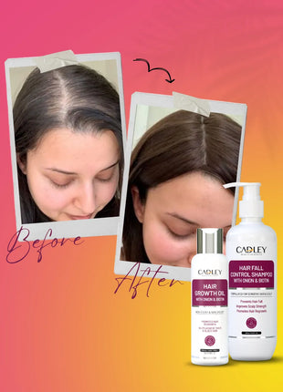 Hair Fall Control & Hair Growth Bundle
