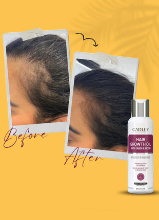 Hair Growth Oil with Biotin & Onion