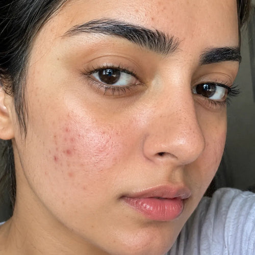 WEEK 1