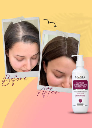 Hair Fall Control Shampoo with Biotin & Onion