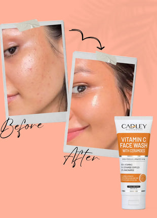 Vitamin C Face Wash with Ceramides
