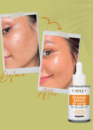 Vitamin C Serum with Ceramides